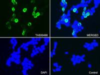CTAG1B antibody [3F10]
