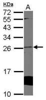Cytoglobin antibody