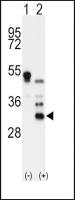Apolipoprotein D antibody, N-term