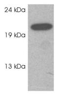 RAB3C antibody