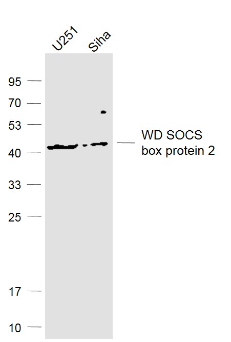 WSB2 antibody