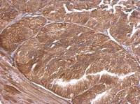 alpha Adducin antibody