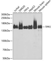Tripeptidyl peptidase II antibody