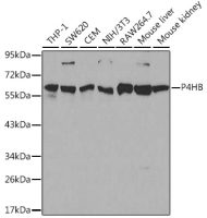 PDI antibody