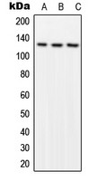 FAK (phospho Tyr576) antibody