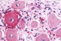 5-HT1D receptor antibody