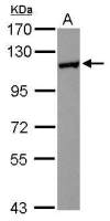 HIP1R antibody [N1N2], N-term