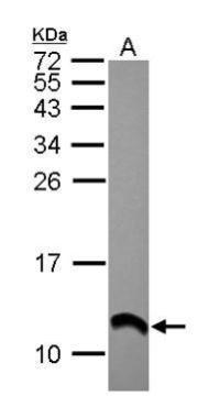 S100 alpha 2 antibody [N1C3]