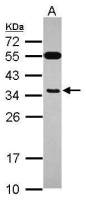 EXOSC8 antibody