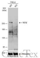 TET2 antibody