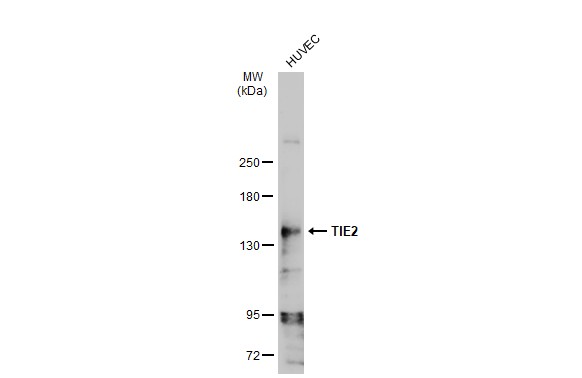 TIE2 antibody