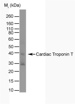 Cardiac Troponin T antibody [TT44 (BGN/1288/44)]