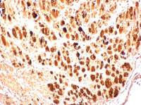 Enterovirus 71 3AB antibody