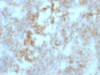 CD147 antibody [BSG/963]