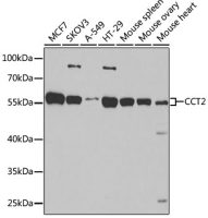 TCP1 beta antibody