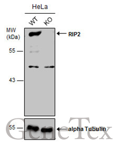 RIP2 antibody [C1C3]