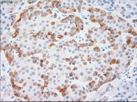 Cytokeratin 18 antibody [1H10]