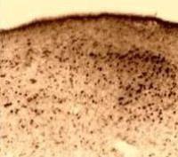 Estrogen Receptor beta antibody