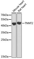 Cardiac Troponin T antibody
