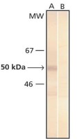 Phosphoserine antibody [3C171]