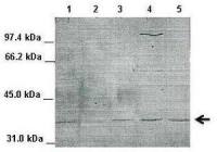 IKB alpha antibody, Internal