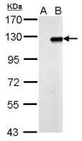 ZNF711 antibody