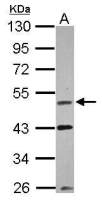 VRK1 antibody