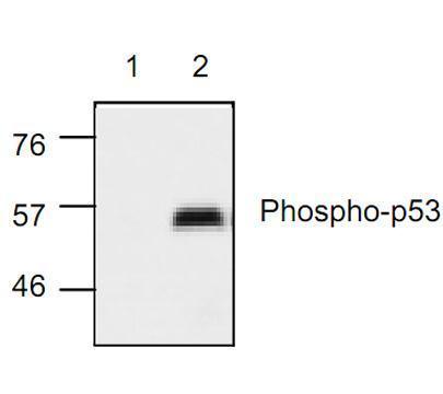 p53 (phospho Ser15) antibody