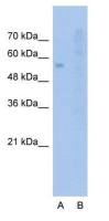 SLC22A1 antibody, N-term