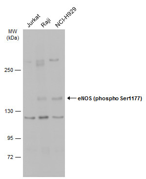 eNOS (phospho Ser1177) antibody