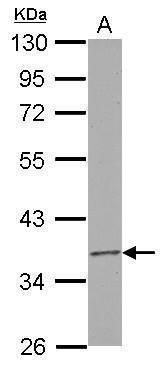 RPUSD3 antibody [N3C3]