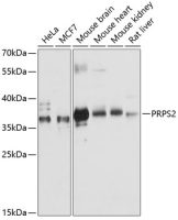 PRPS2 antibody