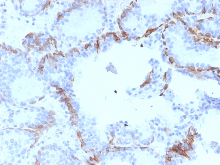 Cytokeratin 6 antibody [KRT6A/2368]