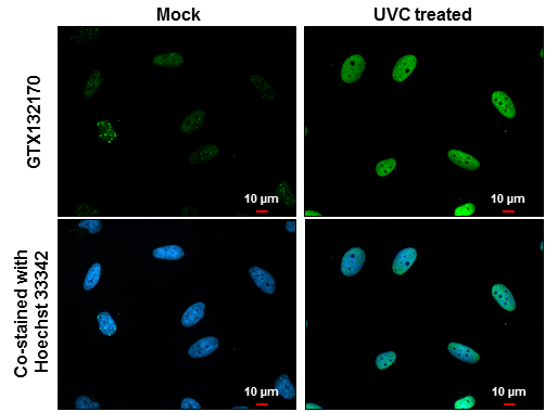 Chk1 (phospho Ser317) antibody