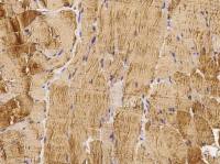 Angiopoietin-like 4 antibody