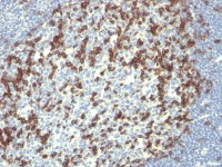 PD1 antibody [PDCD1/922]