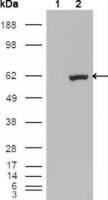 ER81 antibody [1C8B6]