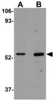 CCDC47 antibody