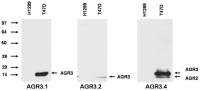 AGR2+AGR3 antibody [AGR3.4]