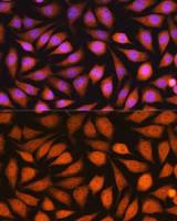 14-3-3 epsilon antibody
