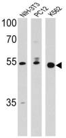 PPAR delta antibody