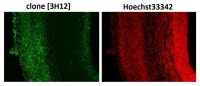 SUMO2 + SUMO3 antibody [3H12]