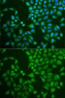 Pancreatic Lipase antibody