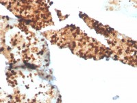 S100P antibody [S100P/4386R]