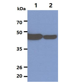 NSE antibody [AT17D10]
