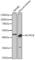 Activin Receptor Type IB antibody
