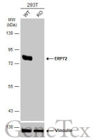 ERP72 antibody