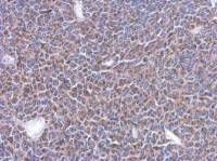MRPL14 antibody