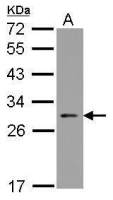 NOL3 antibody