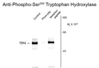 TPH1 (phospho Ser260) antibody